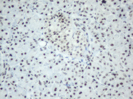 SF3A1 Antibody in Immunohistochemistry (Paraffin) (IHC (P))