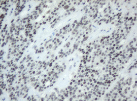 SF3A1 Antibody in Immunohistochemistry (Paraffin) (IHC (P))