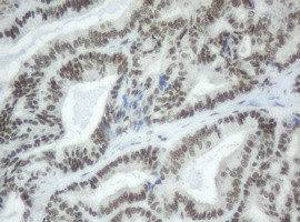 SF3A1 Antibody in Immunohistochemistry (Paraffin) (IHC (P))