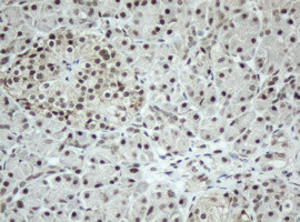 SF3A1 Antibody in Immunohistochemistry (Paraffin) (IHC (P))