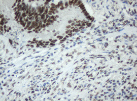 SF3A1 Antibody in Immunohistochemistry (Paraffin) (IHC (P))