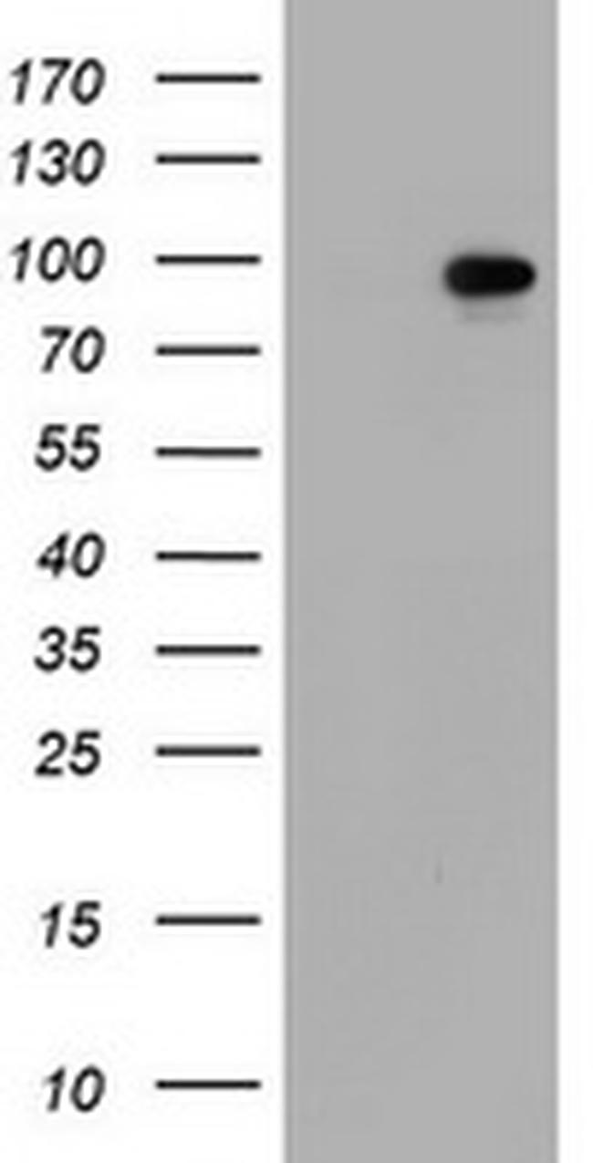 SF3A1 Antibody in Western Blot (WB)