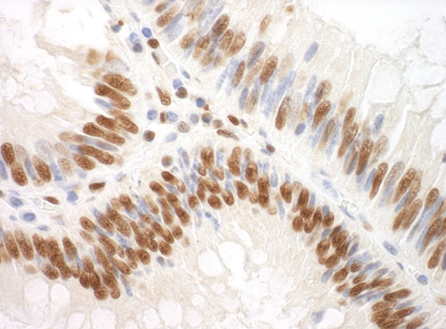 SF3A3 Antibody in Immunohistochemistry (IHC)