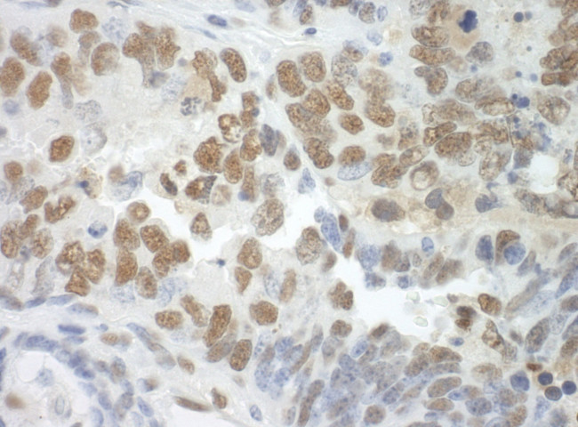 SF3A3 Antibody in Immunohistochemistry (IHC)