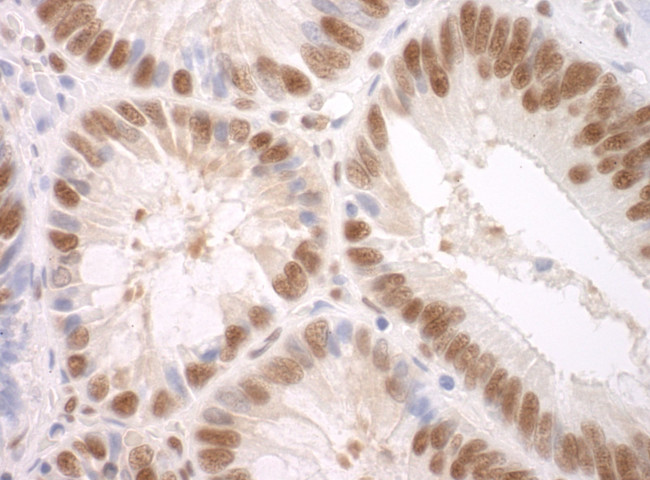 SF3A3 Antibody in Immunohistochemistry (IHC)