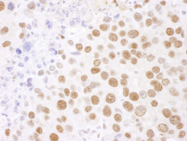 SF3B4 Antibody in Immunohistochemistry (IHC)