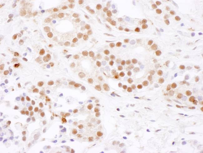 SF3B4 Antibody in Immunohistochemistry (IHC)