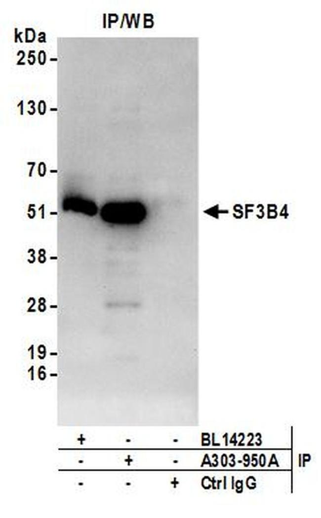 SF3B4 Antibody in Western Blot (WB)