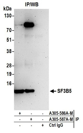 SF3B5 Antibody in Immunoprecipitation (IP)