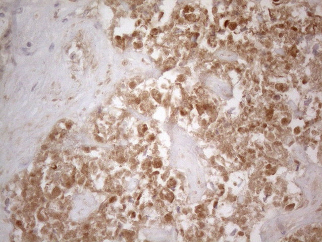 SFRP2 Antibody in Immunohistochemistry (Paraffin) (IHC (P))