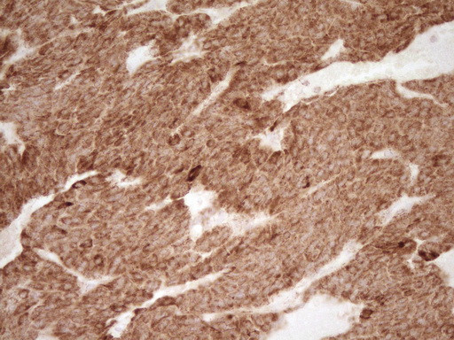 SFRP2 Antibody in Immunohistochemistry (Paraffin) (IHC (P))