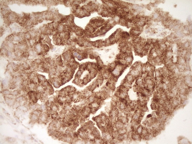 SFRP2 Antibody in Immunohistochemistry (Paraffin) (IHC (P))