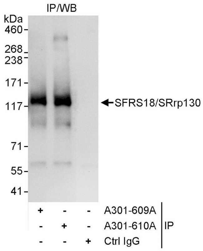 SFRS18/SRrp130 Antibody in Immunoprecipitation (IP)