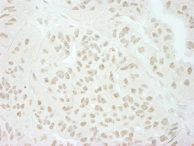 SFRS8/SWAP Antibody in Immunohistochemistry (IHC)