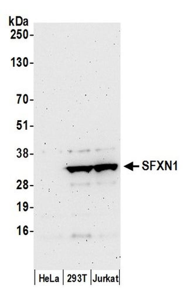 SFXN1 Antibody in Western Blot (WB)