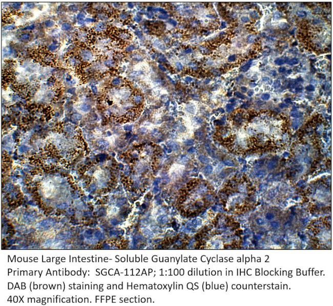 Soluble Guanylyl Cyclase alpha 2 Antibody in Immunohistochemistry (IHC)