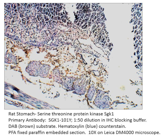 SGK1 Antibody in Immunohistochemistry (IHC)