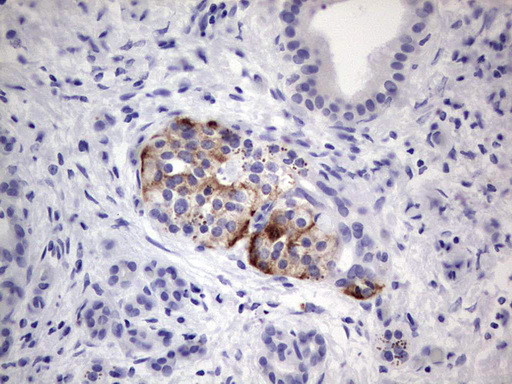 SGK196 Antibody in Immunohistochemistry (Paraffin) (IHC (P))