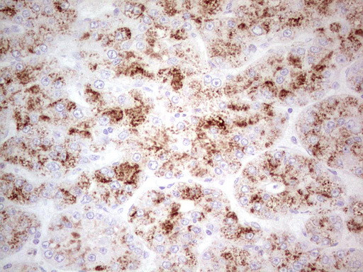 SGK196 Antibody in Immunohistochemistry (Paraffin) (IHC (P))