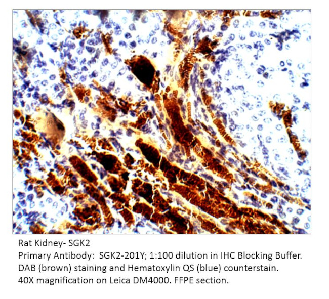 SGK2 Antibody in Immunohistochemistry (IHC)