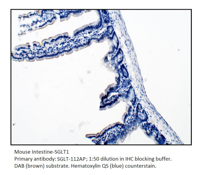 SGLT1 Antibody in Immunohistochemistry (IHC)