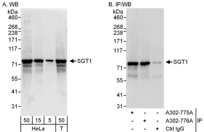 GCR2/SGT1 Antibody in Western Blot (WB)