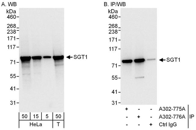 GCR2/SGT1 Antibody in Western Blot (WB)