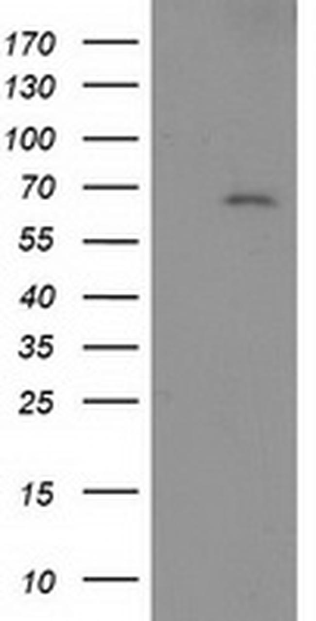 SH2B3 Antibody in Western Blot (WB)