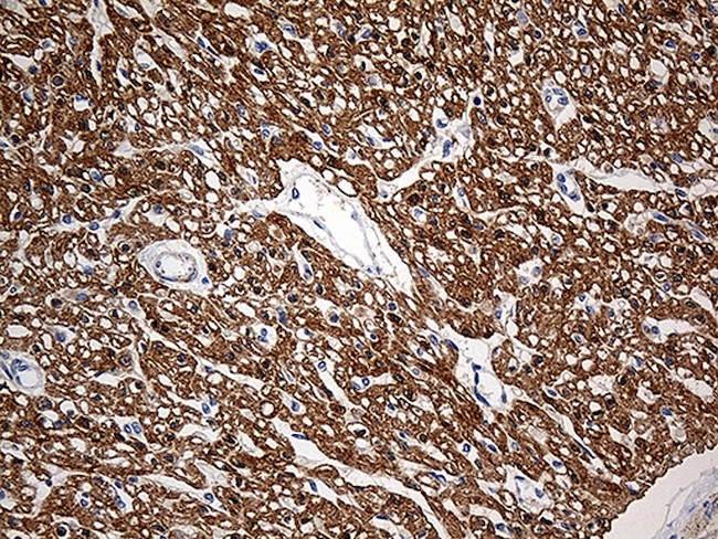 SH3BGR Antibody in Immunohistochemistry (Paraffin) (IHC (P))