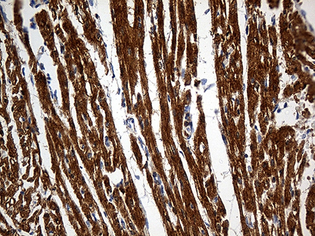 SH3BGR Antibody in Immunohistochemistry (Paraffin) (IHC (P))