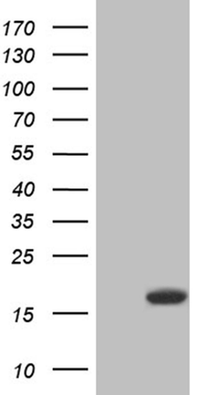 SH3BGRL Antibody in Western Blot (WB)