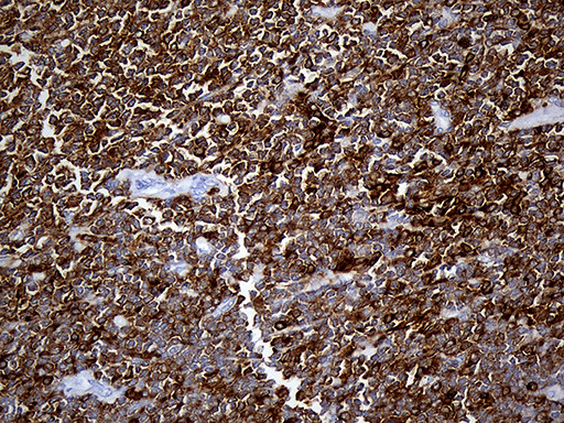 SH3BP1 Antibody in Immunohistochemistry (Paraffin) (IHC (P))