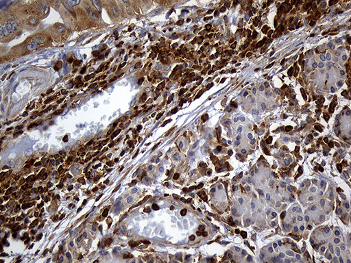 SH3BP1 Antibody in Immunohistochemistry (Paraffin) (IHC (P))