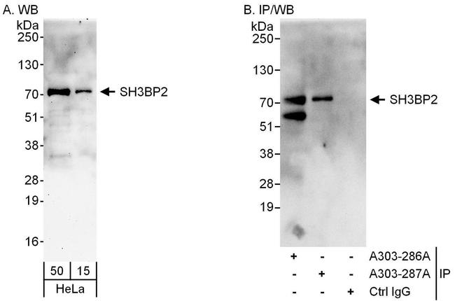 SH3BP2 Antibody in Western Blot (WB)