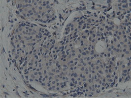 SH3GL1 Antibody in Immunohistochemistry (Paraffin) (IHC (P))