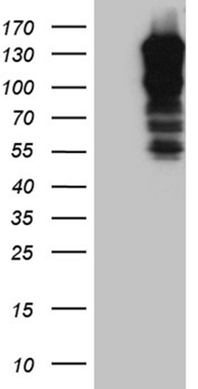 SH3PXD2A Antibody in Western Blot (WB)