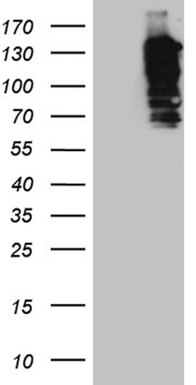 SH3PXD2A Antibody in Western Blot (WB)