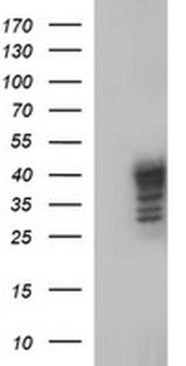 SHBG Antibody in Western Blot (WB)