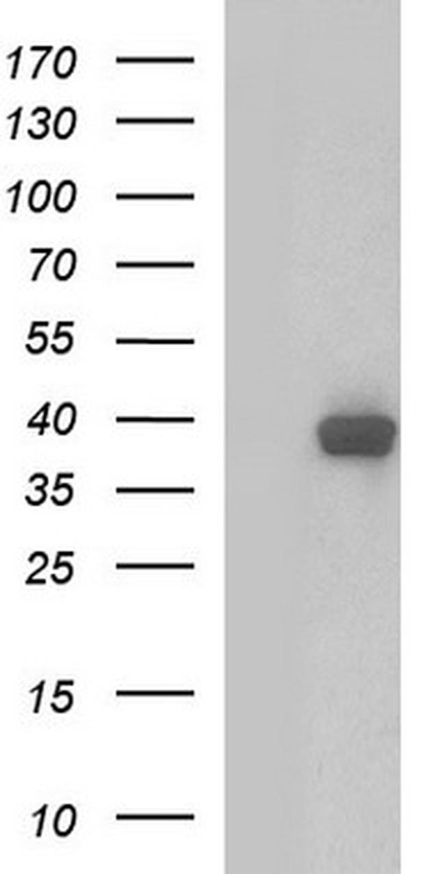 SHBG Antibody in Western Blot (WB)