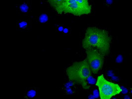 SHC1 Antibody in Immunocytochemistry (ICC/IF)