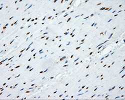 SHC1 Antibody in Immunohistochemistry (Paraffin) (IHC (P))