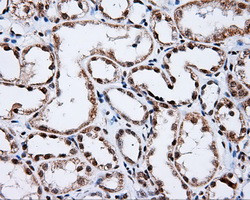 SHC1 Antibody in Immunohistochemistry (Paraffin) (IHC (P))