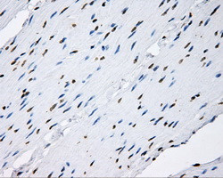 SHC1 Antibody in Immunohistochemistry (Paraffin) (IHC (P))