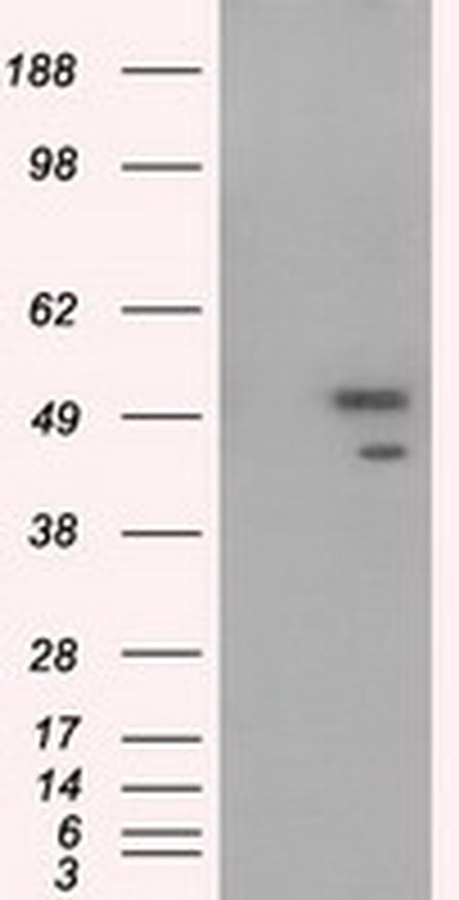 SHC1 Antibody in Western Blot (WB)