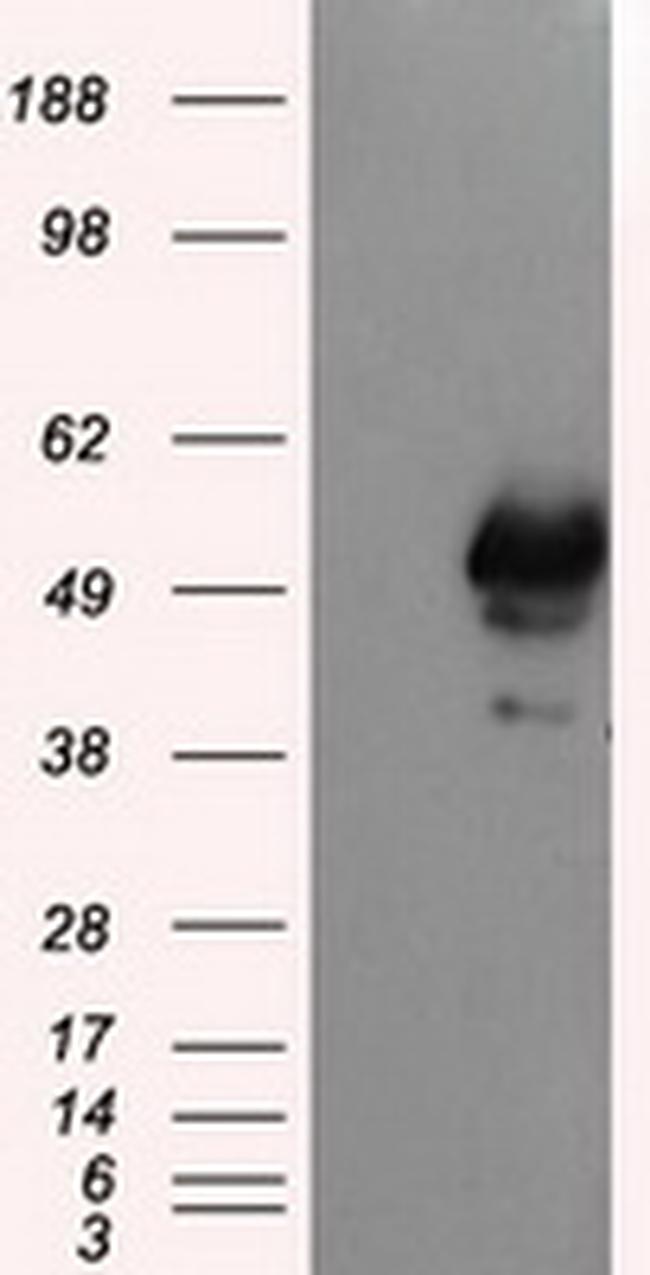 SHC1 Antibody in Western Blot (WB)