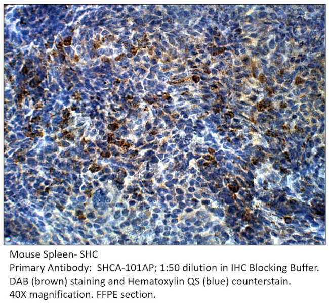 SHC Antibody in Immunohistochemistry (IHC)