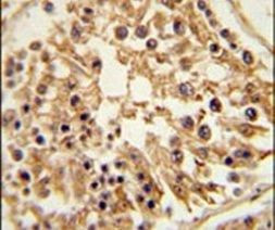 SHCBP1 Antibody in Immunohistochemistry (IHC)