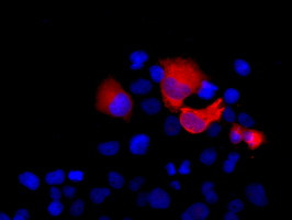 SHH Antibody in Immunocytochemistry (ICC/IF)