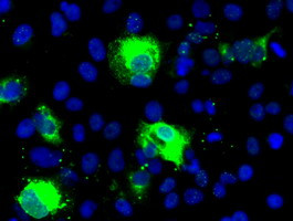 SHH Antibody in Immunocytochemistry (ICC/IF)