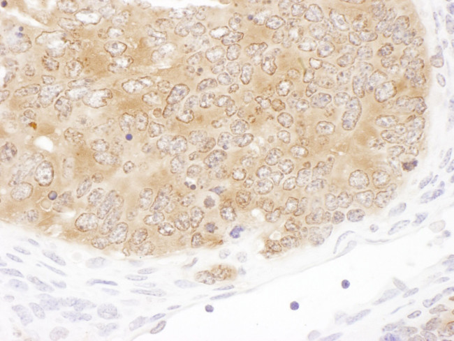 SHMT1 Antibody in Immunohistochemistry (IHC)